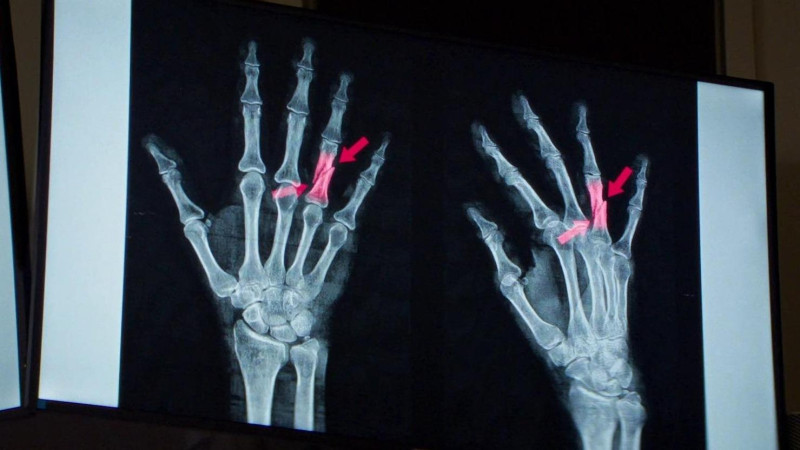 Photo du film Anatomie d&rsquo;une chute